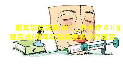 附耳切除需要 🕸 多少疗 🐧 程完成(附耳切除需要多少疗程完成手术)